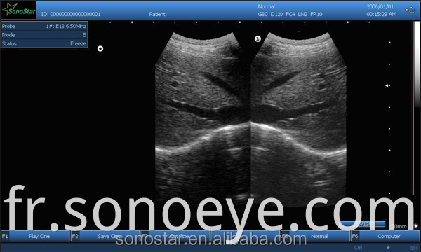 image for labtop ultrasound